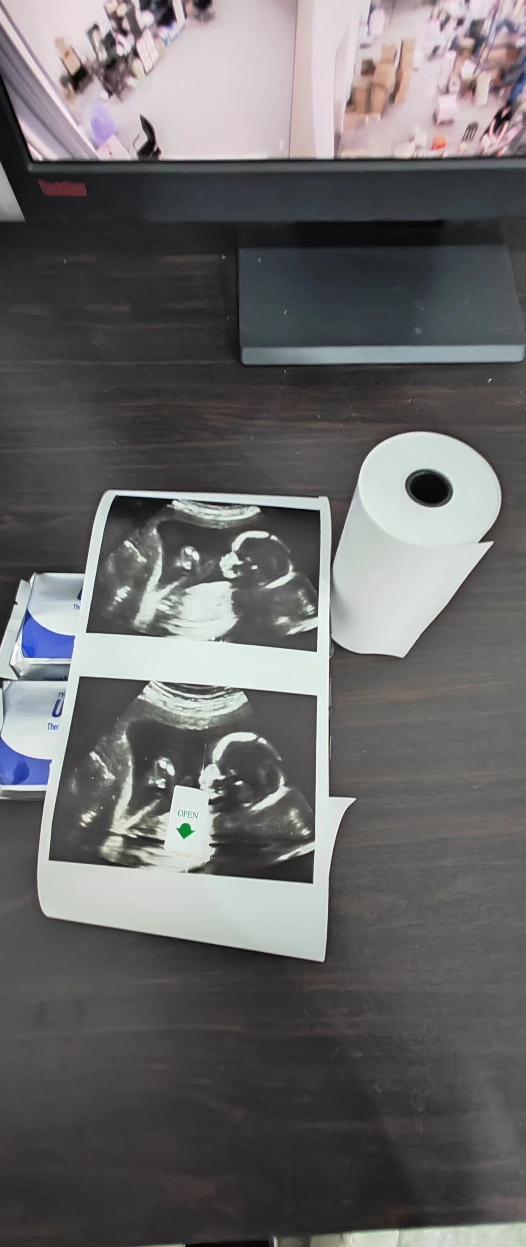 Thermal medical record paper 3